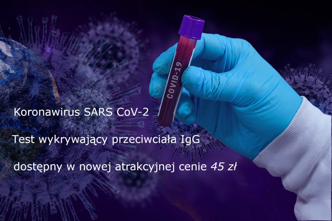 Koronawirus -testy na przeciwciała IgG